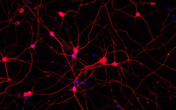 Una proteína que en exceso termina asociada a enfermedades neurodegenerativas