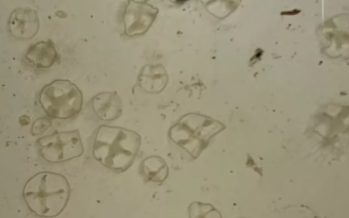 Alerta ambiental en Bariloche: detectan medusas invasoras en los lagos Escondido y El Trébol