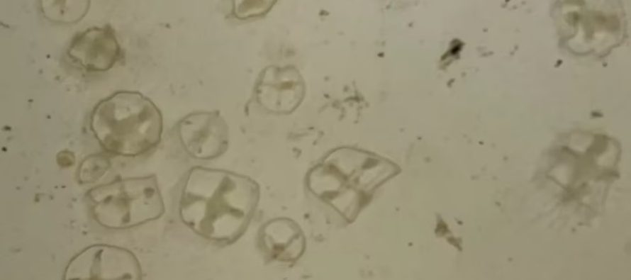 Alerta ambiental en Bariloche: detectan medusas invasoras en los lagos Escondido y El Trébol